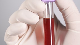 bloodborne pathogens training online.